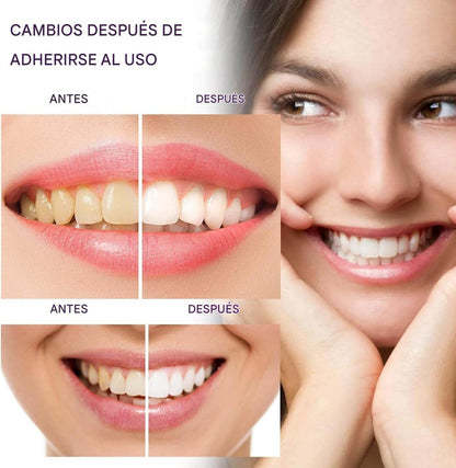 mostra tu sonrisa, mostra los dientes