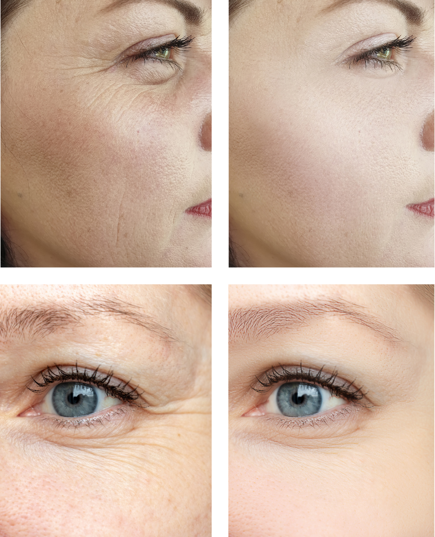 EL TRATAMIENTO FACIAL QUE ELEVA TU ROSTRO AL INSTANTE