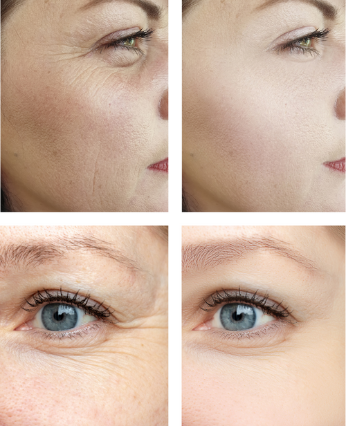 EL TRATAMIENTO FACIAL QUE ELEVA TU ROSTRO AL INSTANTE